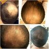 () DEKOHAIR - эффективное средство для борьбы с выпадением волос, 60мл